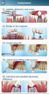 Screenshot Dental 3D Illustrations Mod APK