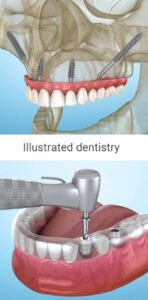 Screenshot Dental 3D Illustrations Mod APK